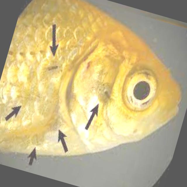 Parasitic Diseases Koki 005