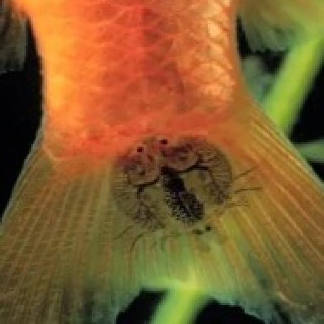 Parasitic Diseases Koki 020